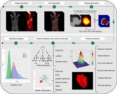 Habitat Imaging-Based 18F-FDG PET/CT Radiomics for the Preoperative Discrimination of Non-small Cell Lung Cancer and Benign Inflammatory Diseases